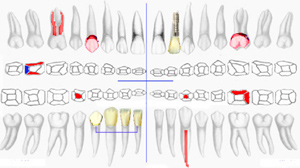 Scheda Dentale
